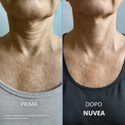 Nuvea® Crema per il collo rassodante e sollevante