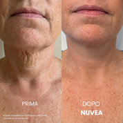 Nuvea® Crema per il collo rassodante e sollevante
