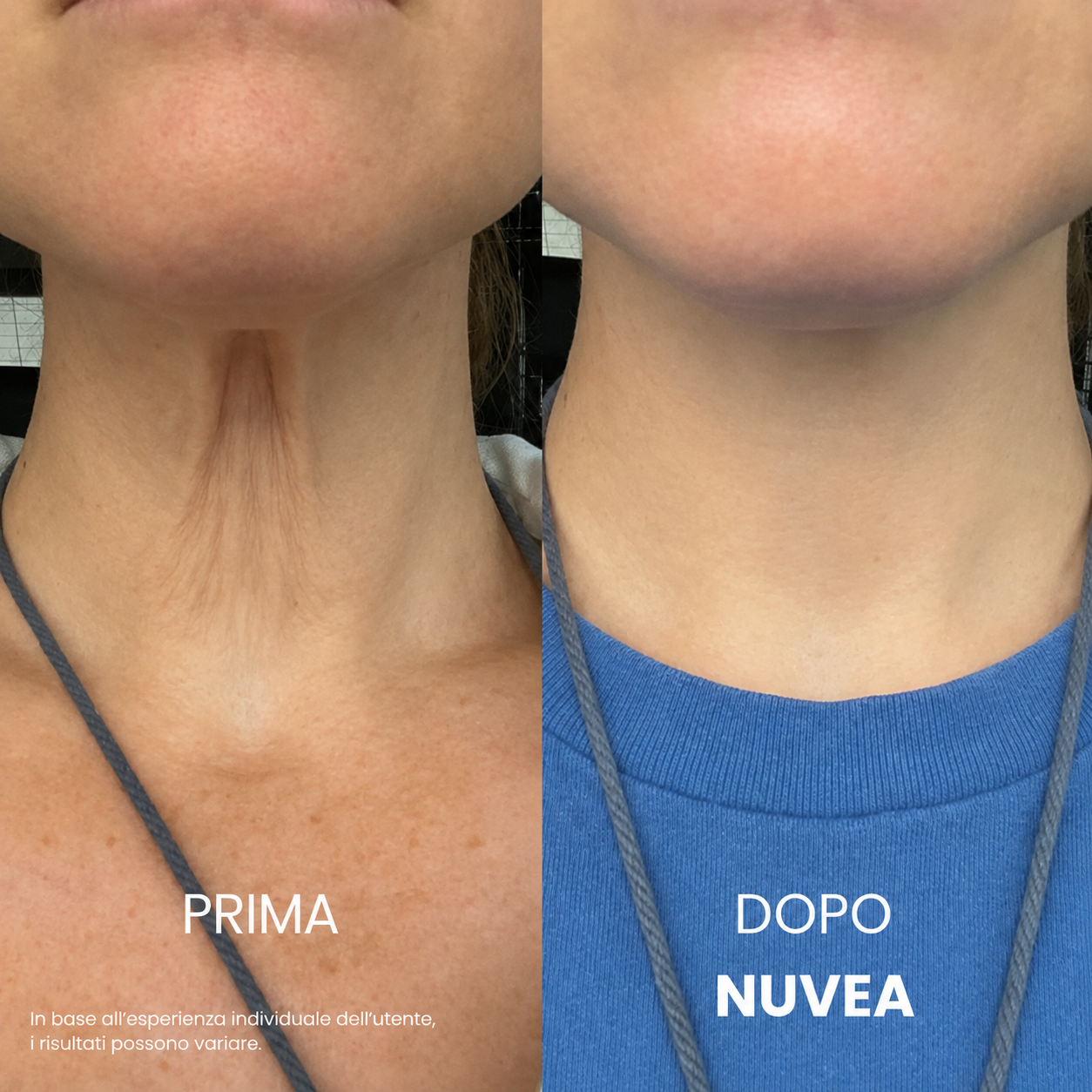 Nuvea® Crema per il collo rassodante e sollevante