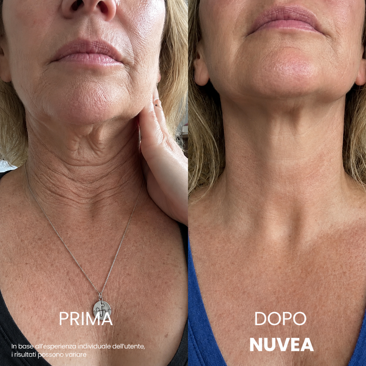 Nuvea® Crema per il collo rassodante e sollevante