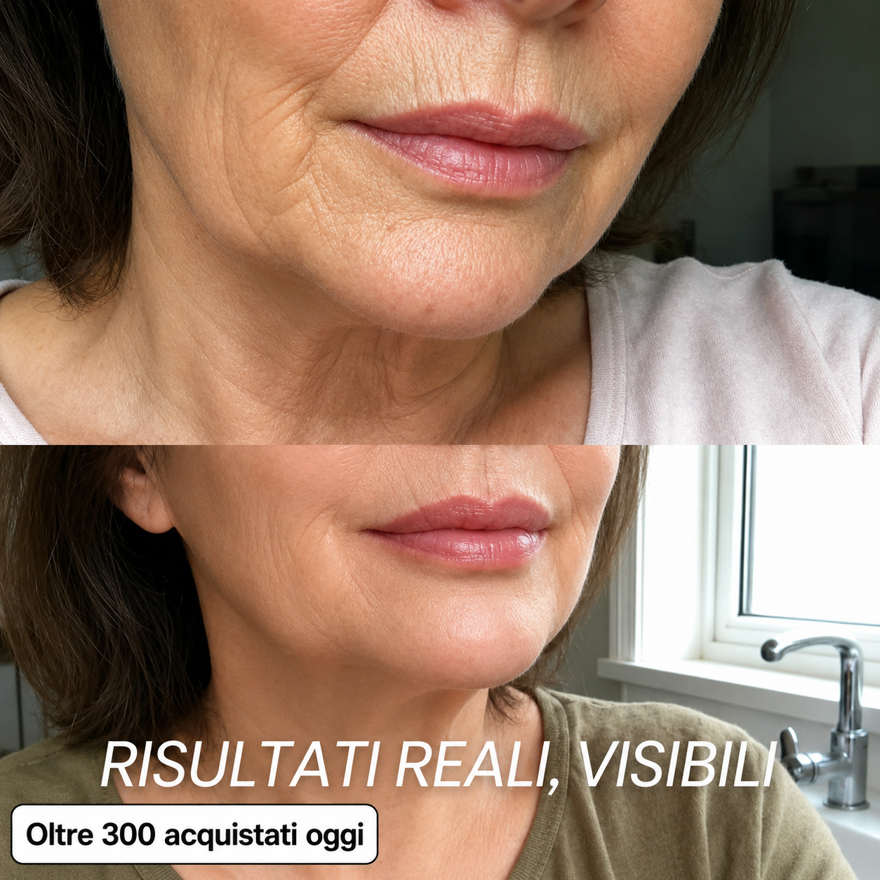 Stick rimpolpante al biocollagene PDRN