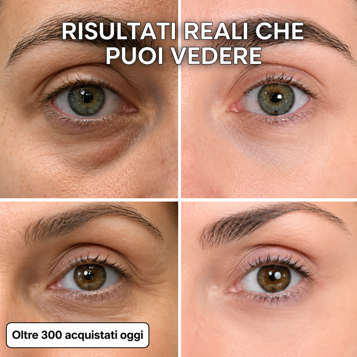 Stick rimpolpante al biocollagene PDRN