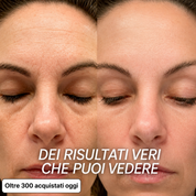 Stick rimpolpante al biocollagene PDRN